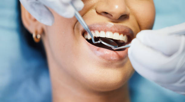 Best Emergency Dentist for Knocked-Out Tooth in Butler Beach, FL